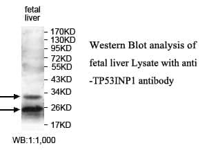 Anti-TP53INP1
