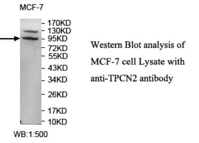 Anti-TPCN2
