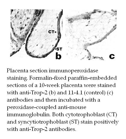 Anti-human TACSTD2/TROP-2 Monoclonal