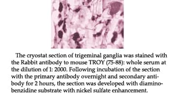Anti-Mouse TROY  (75-88)