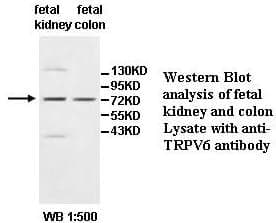 Anti-TRPV6