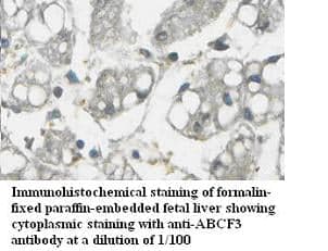 Anti-ABCF3