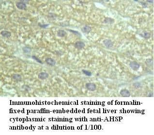 Anti-AHSP