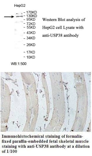 Anti-USP38