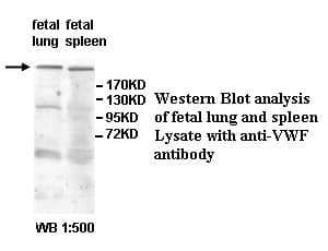 Anti-VWF