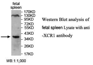 Anti-XCR1
