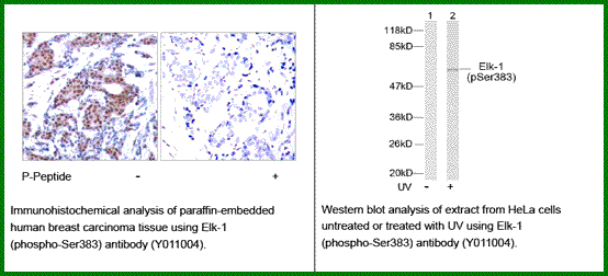 Anti-Elk-1 (Phospho-Ser383)