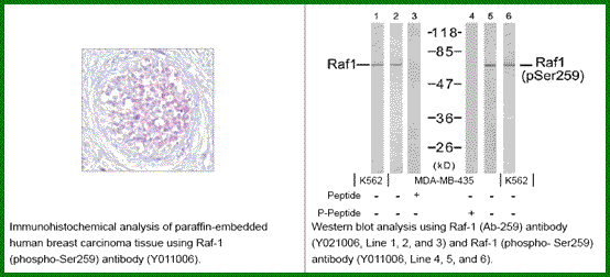 Anti-Raf1 (Phospho-Ser259)