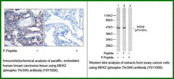 Anti-MEK2 (Phospho-Thr394)