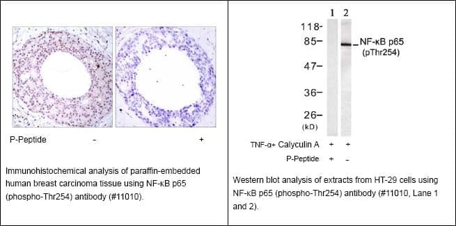 Anti-NF-kB p65 (Phospho-Thr254)