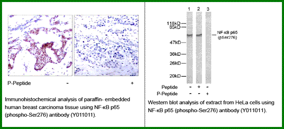 Anti-NF-kB p65 (Phospho-Ser276)