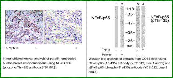 Anti-NF-kB p65 (Phospho-Thr435)