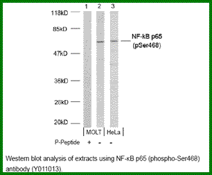 Anti-NF-kB p65 (Phospho-Ser468)