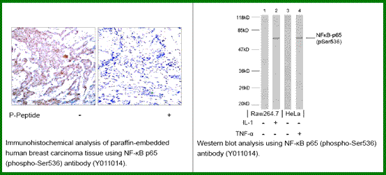 Anti-NF-kB p65 (Phospho-Ser536)