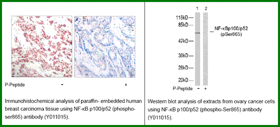 Anti-NF-kB p100/p52 (Phospho-Ser865)