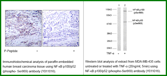 Anti-NF-kB p100/p52 (Phospho-Ser869)