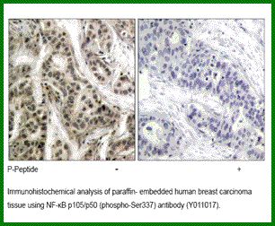 Anti-NF-kB p105/p50 (Phospho-Ser337)