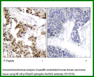 Anti-NF-kB p105/p50 (Phospho-Ser893)