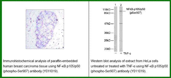 Anti-NF-kB p105/p50 (Phospho-Ser907)