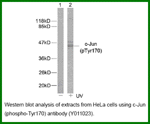 Anti-c-Jun (Phospho-Tyr170)