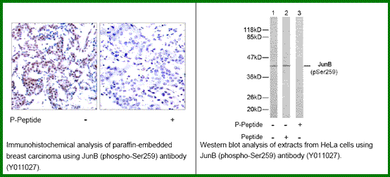 Anti-JunB (Phospho-Ser259)
