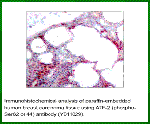 Anti-ATF2 (Phospho-Ser44(Ser62))