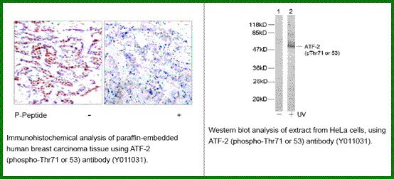 Anti-ATF2 (Phospho-Thr53(Thr71))
