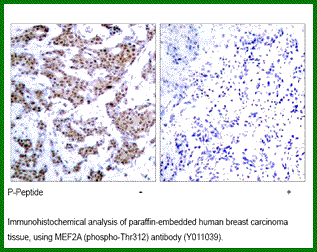 Anti-MEF2A (Phospho-Thr312)