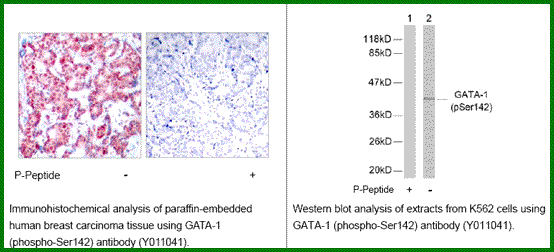 Anti-GATA1 (Phospho-Ser142)