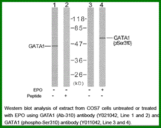Anti-GATA1 (Phospho-Ser310)