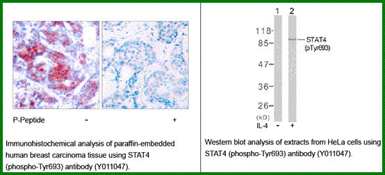 Anti-STAT4 (Phospho-Tyr693)
