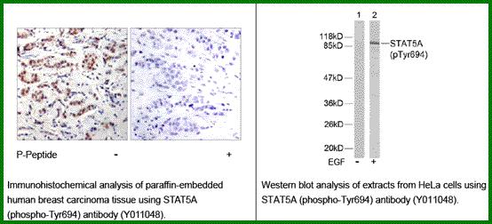 Anti-STAT5A (Phospho-Tyr694)