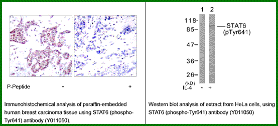 Anti-STAT6 (Phospho-Tyr641)