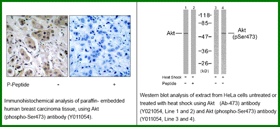 Anti-Akt (Phospho-Ser473)