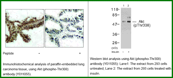 Anti-Akt (Phospho-Thr308)
