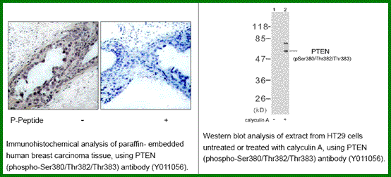 Anti-PTEN (Phospho-Ser380/Thr382/Thr383)