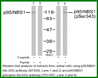 Anti-p95/NBS1 (Phospho-Ser343)
