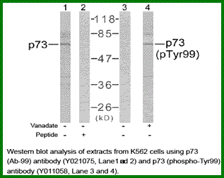 Anti-p73 (Phospho-Tyr99)