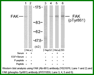 Anti-FAK (Phospho-Tyr861)