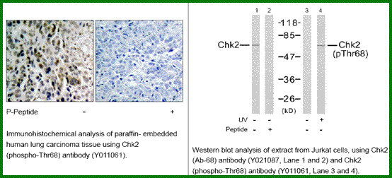Anti-Chk2 (Phospho-Thr68)