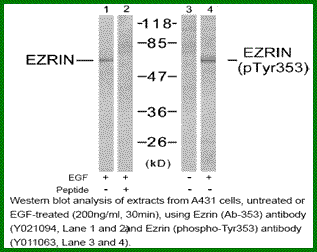 Anti-Ezrin (Phospho-Tyr353)