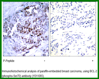 Anti-BCL (Phospho-Ser70)