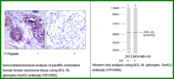 Anti-BCL-XL (Phospho-Ser62)