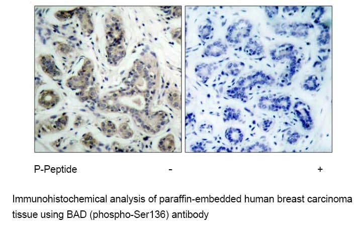 Anti-BAD (Phospho-Ser136)