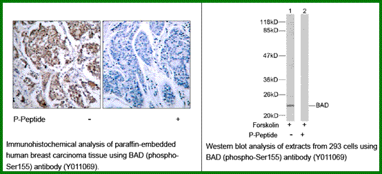 Anti-BAD (Phospho-Ser155)