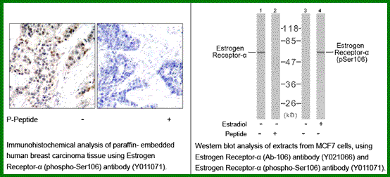 Anti-Estrogen Receptor-&alpha; (Phospho-Ser106)