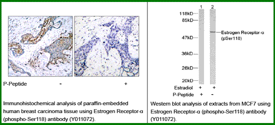 Anti-Estrogen Receptor-&szlig; (Phospho-Ser118)