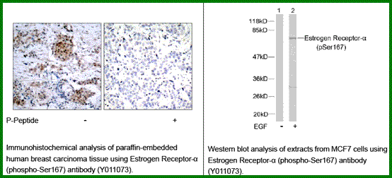 Anti-Estrogen Receptor-&szlig; (Phospho-Ser167)