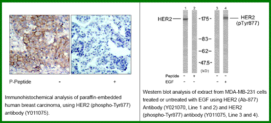 Anti-HER2 (Phospho-Tyr877)