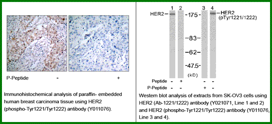 Anti-HER2 (Phospho-Tyr1221/Tyr1222)
